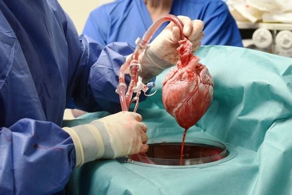 First of its kind – GM Pig heart successfully transplanted into a man